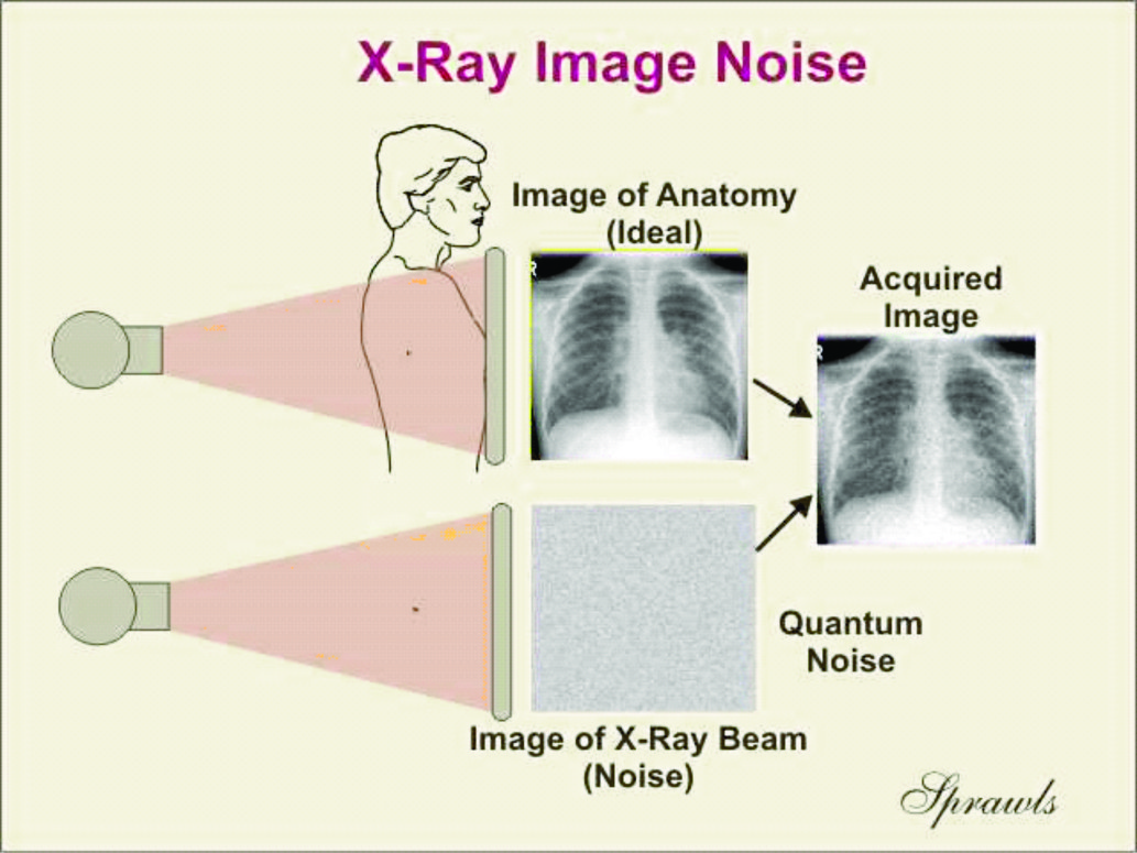 Sprawls Visuals for Teaching Medical Imaging